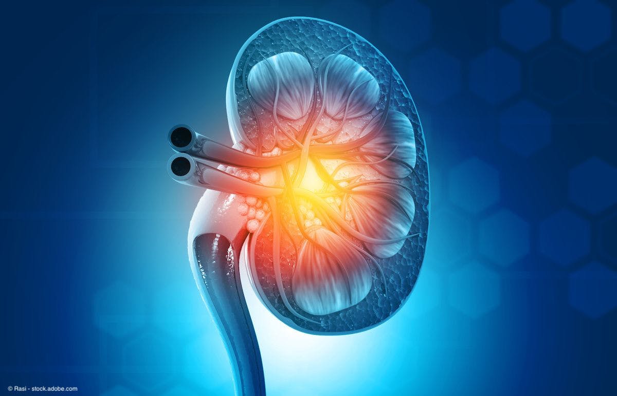 Adjuvant pembrolizumab improves overall survival in certain patients with renal cell carcinoma